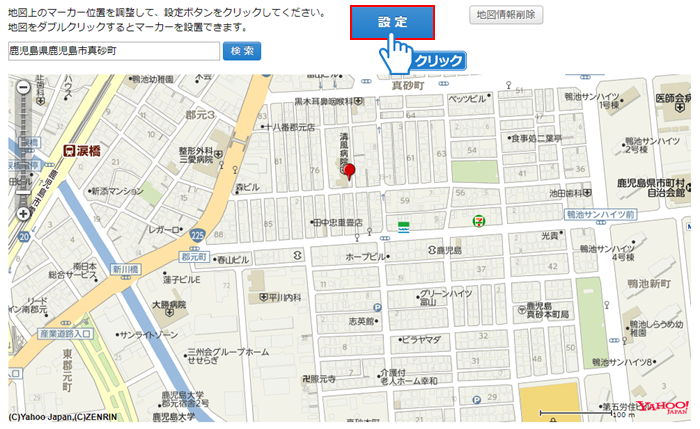 「設定」ボタンをクリック